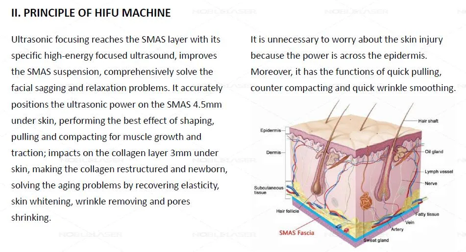 10000 Shots 3D Hifu 11 Lines Wrinkle Removal Noble Laser